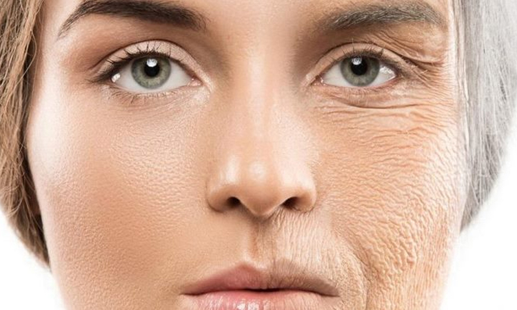 پیری زودرس پوست